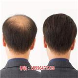攀枝花定制真人假發(fā)哪里好_攀枝花定制假發(fā)多少錢(qián)_千絲堂假發(fā)店