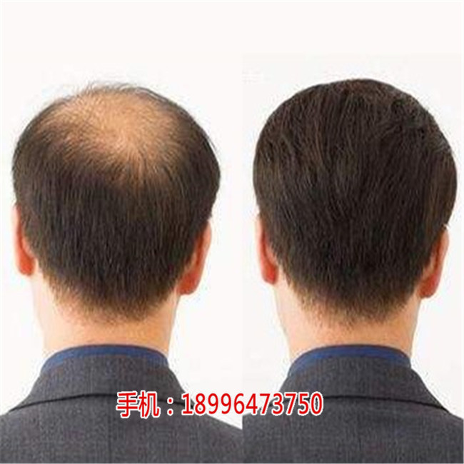 重庆假发批发商_重庆假发头套批发_千丝堂假发店