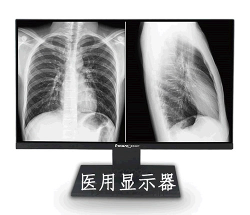 【專業診斷顯示設備】普東醫療廠家