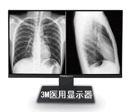 【放射科医用显示器】普东医疗厂家