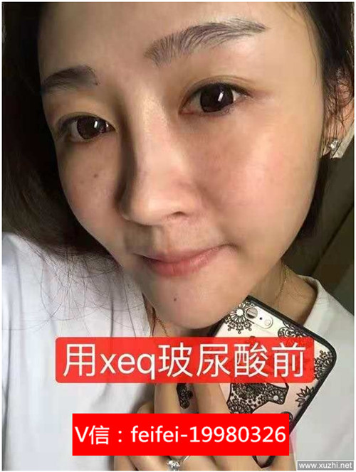 自制xeq玻尿酸原液精华液视频【代理如何做】xeq玻尿酸原液精华液瓶盖怎么打开