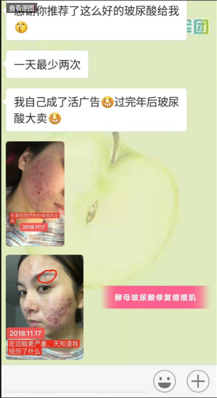 xeq玻尿酸原液精華液用后爆痘【代理如何做】綻媄婭xeq玻尿酸原液精華液怎么用