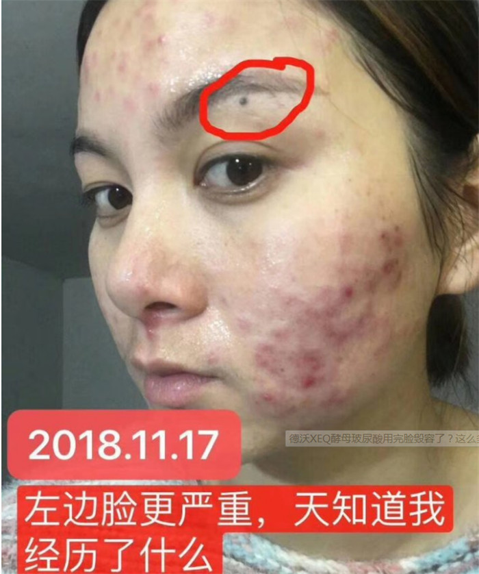 香港塑形xeq玻尿酸原液精華液【代理如何做】xeq玻尿酸原液精華液如何正確使用