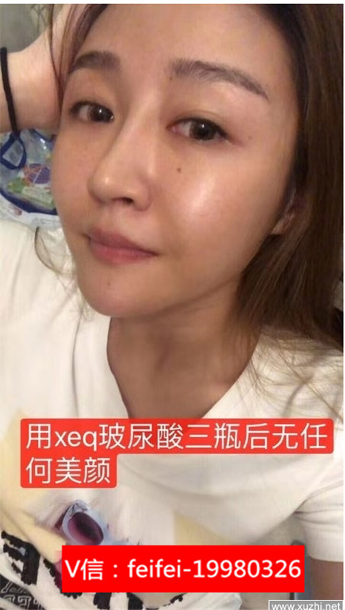 恩喜伊美xeq玻尿酸原液精華液【代理如何做】xeq玻尿酸原液精華液是在水乳后嗎